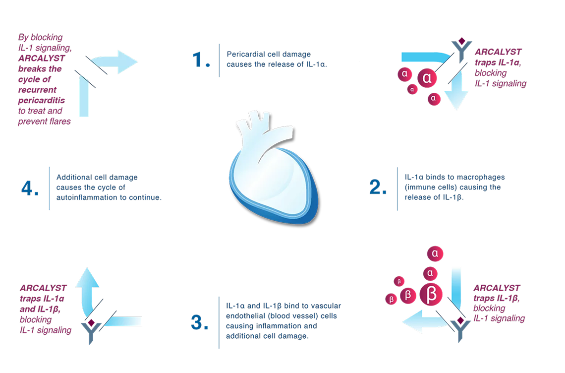 The Cycle of Autoinflammation in Recurrent Pericarditis: 1. Pericardial cell damage causes the release of IL-1α, 2. IL-1α binds to macrophages (immune cells) causing the release of IL-1β, 3.IL-1α and IL-1β bind to vascular endothelial (blood vessel) cells causing inflammation and additional cell damage, 4. Additional cell damage causes the cycle of autoinflammation to continue.