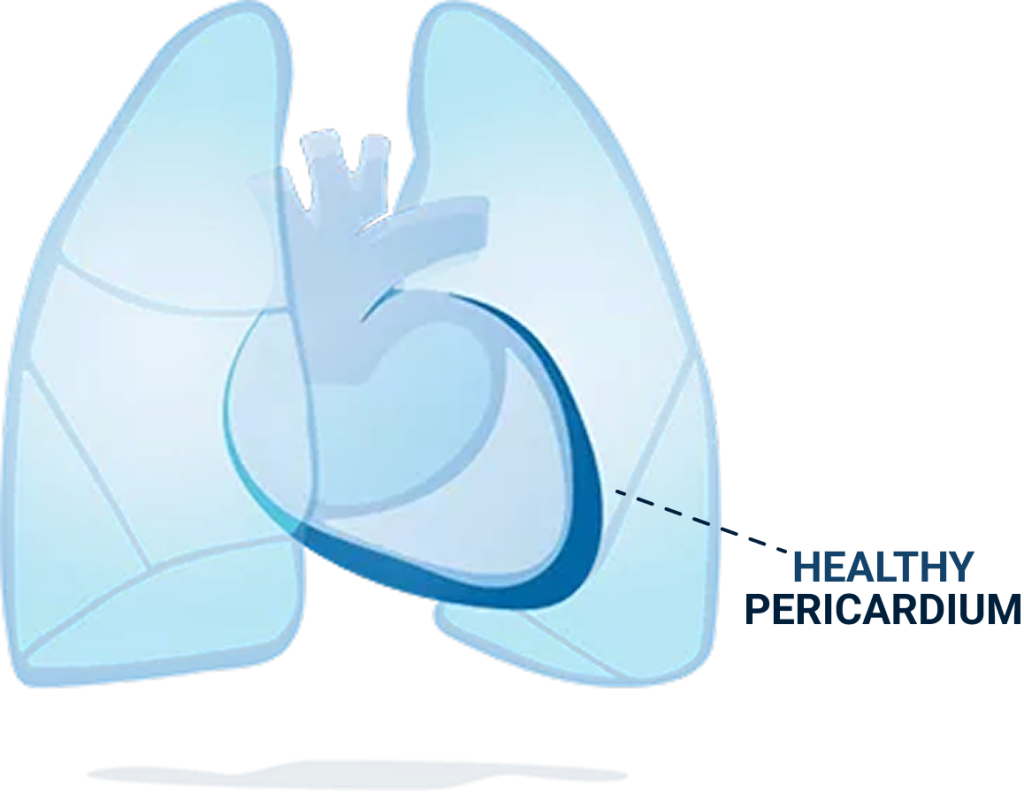 Healthy pericardium.
